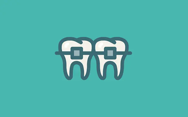 Ortodoncia en CDMX - Tratamiento de alineación dental en AVDENTAL